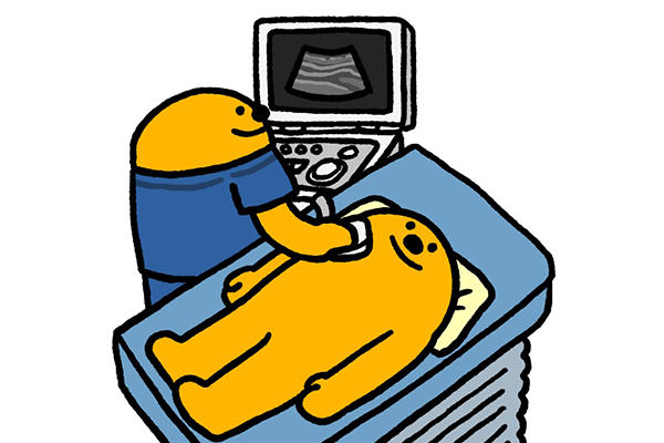 頚部血管超音波検査