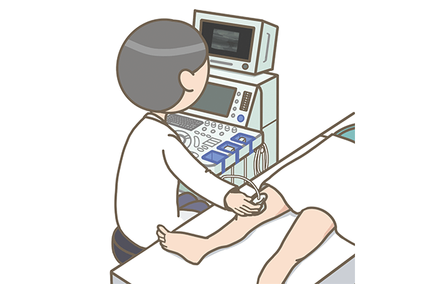 下肢血管超音波検査
