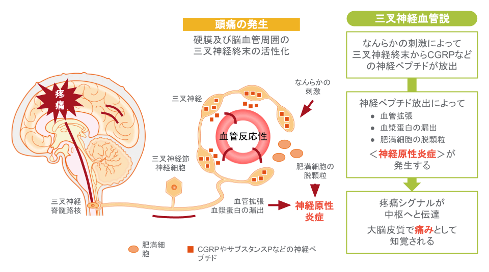 三叉神経血管説