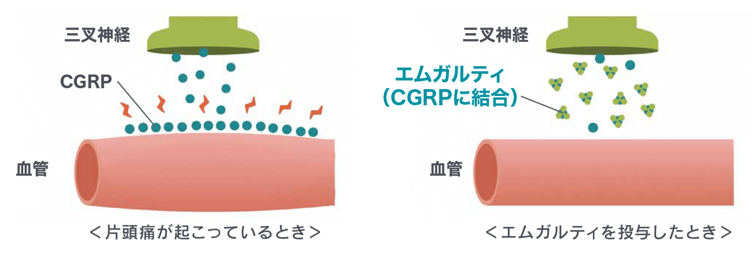 ガルカネズマブ（エムガルティ）の作用機序